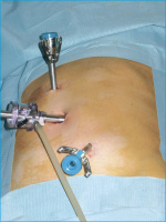 Abbildung 1a: DaVinci-System