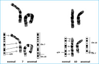 Abbildung 5: Translokation
