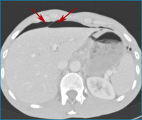 Abbildung 3: Lungenfenster