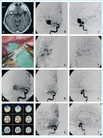 Abbildung 11a-l: Kombinierte Therapie
