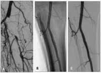 Abbildung 3a-b: Ischämie