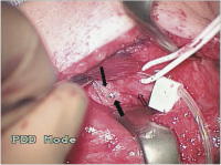 Abbildung 3: Elektrodenrevision