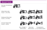 Abbildung 1: Genant Score