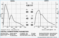 Abbildung 1: Pulswellenanalyse