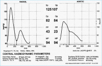 Abbildung 1b: Pulswellenanalyse