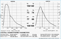 Abbildung 2a: Pulswellenanalyse