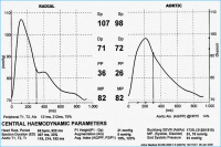 Abbildung 2b: Pulswellenanalyse
