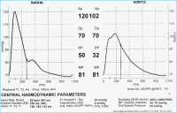 Abbildung 3b: Pulswellenanalyse